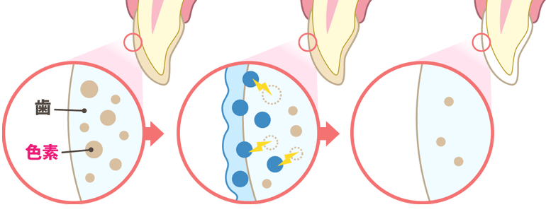 ホワイトニングの仕組み
